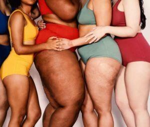 Read more about the article What is Cellulite and how to get rid of cellulite?