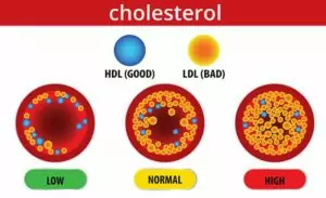 Read more about the article How to lower cholesterol? | What is cholesterol?